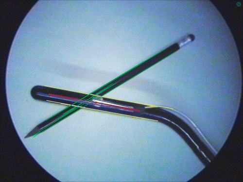 Figure 2. Screenshot of axis segmentation. Lines classified as belonging to the transducer tip edges are automatically colored yellow; lines belonging to the transducer (but not to the edges) are colored blue; and the corrected transducer axis is the thick red line. Lines belonging to the pencil are rejected (colored green), because they do not match the measured transducer axis rotation. [Color version available online.]