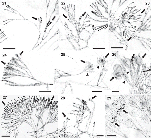 Figs 21–29. Renouxia marerubra sp. nov. Fig. 21. First gonimoblast initials (arrows). Fig. 22. Numerous gonimoblast filaments (arrows). Fig. 23. Gonimoblast filaments (arrows) dividing and growing outwardly reaching the cortex surface. Fig. 24. Gonimoblast filaments with swollen apical cells (arrows). Fig. 25. Remnant terminal carposporangial cell walls (arrows) borne on swollen gonimoblast cells (arrowheads). Fig. 26. Remnant terminal and lateral carposporangial cell walls (arrows) borne on swollen gonimoblast cells (arrowhead), from which secondary gonimoblast initials are issued (double arrowheads). Fig. 27. Spermatangial parent cells (arrows) on the outer cortex. Fig. 28. Fan-like spermatangia bearing numerous spermatia (arrows). Fig. 29. Old clusters of spermatangial parent cells (arrows) located in mid-cortex. Scale bars: Figs 21–24, 27, 29 = 50 μm, Fig. 25 = 100 μm, Figs 26, 28 = 20 μm.