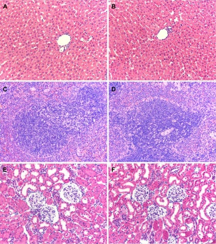 Figure 7 Hematoxylin and eosin staining of liver, spleen, and kidney from rats treated with CS and BMP/CS at 7 days after surgery. (A) Liver of CS group (×200). (B) Liver of BMP/CS group (×200). (C) Spleen of CS group (×200). (D) Spleen of BMP/CS group (×200). (E) Kidney of CS group (×200). (F) Kidney of BMP/CS group (×200).Abbreviations: BMP/CS, bone morphogenetic protein 2 gene-modified cell sheet; CS, cell sheet.