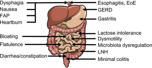 Figure 1 GI symptoms (left side) and GI disorders (right side) described in children with autism spectrum disorder.