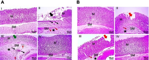 Figure 6 Histopathological examination of glandular stomach of rats following (A) concurrent induction and treatment regimen and (B) post-treatment regimen.Notes: (I) Normal control group, (II) positive control group, (III) free APO treated group, and (IV) APO-loaded COS-NPs (F4) treated group. Oral dose of free or loaded APO was 14 mg/kg. Thick black arrow points to extensive areas of ulceration. Thick green arrow points to decreased thickness of mucosa due to loss of superficial epithelial layers. Thick red arrows point to focal erosion. Thin black arrows point to congested blood vessels. Thin red arrows point to leukocytic cells' infiltration. Asterisk points to edema. H&E, 100×.Abbreviations: APO, apocynin; COS, chitosan oligosaccharide; M, mucosa; H & E, hematoxylin and eosin; NPs, nanoparticles; SM, submucosa.