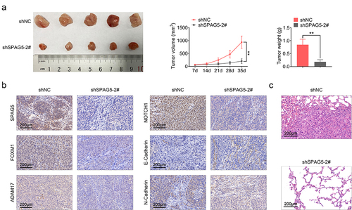 Figure 6. Downregulation of SPAG5 weakened the in vivo tumor formation ability of A375 cells. (a) Tumor volume and weight. (b) The expression of SPAG5, FOXM1, ADAM17, NOTCH1, E-cadherin and N-cadherin in shNC and shSPAG5-2 groups were detected using IHC. (c) Hematoxylin eosin staining was used to assess the lung metastasis of MM (Each group had 5 mice, **P < 0.01).