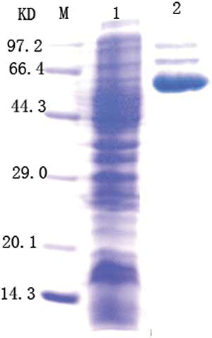 Figure 5.  Purified recombinant urate oxidase according to SDS-PAGE (12%) analysis. Lane M—a low molecular weight protein ladder. Lane 1—the crude lysate from the recombinant Lactobacillus expressing urate oxidase (Lb-PMG36e-U). Lane 2—recombinant uricase purified using diethylaminoethyl (DEAE) DE52.