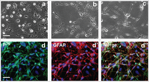 Figure 1. Morphological and biochemical properties of primary olfactory ensheathing cells. (A) Primary OECs at 7 d of culture. (B, C) Primary OECs after purification at 5 and 7 d in vitro. (d-d″) Immunostaining identification revealed expression of p75 and glial fibrillary acidic protein (GFAP). Scale bars = 100 μm.