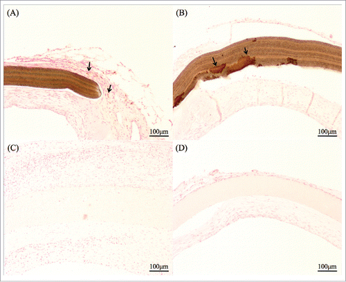 FIGURE 4. Kossa staining indicated calcification in brownish color. (A) ePTFE patch at 4 weeks had some calcified granules. (B) At 3 months, the calcification of the all ePTFE patch itself was observed. (C) SF/Pellethane® patches at a few samples had calcified granules. (D) At 3 months almost samples had only granules and did not react patch itself.