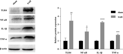 Figure 7. Western blotting analysis of IL-1β, TNF-α, NF-κB and TLR4 in brain tissues of SAH mice. Three days after model establishment, the expression levels of inflammatory cytokines IL-1β, TNF-α and TLR4/NF-κB inflammatory signalling pathway-related proteins, NF-κB, TLR4 were statistically higher in the brain tissues of mice in the SAH model group than in the sham group (all p < 0.05).