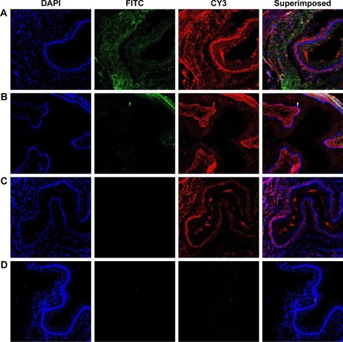 Figure 7 Laser confocal observation of the distribution of nanoparticles in the aorta of atherosclerosis model mice.Notes: (A) Shows the aorta after injection of DiR-ENPs into the atherosclerosis mouse model of HFD group. (B) Shows the aorta after injection of DiR-ENPs in CHD group. (C) Shows the aorta after injection of DiR-NPs in HFD group. (D) is the aorta after PBS injection in HFD group, no incubation with TF antibody. FITC-labeled EGFP-EGF1 site is shown in green and CY3-labeled TF expression site in red. Nuclei were stained with DAPI (blue).Abbreviations: DiR, 1,1′-dioctadecyl-3,3,3′,3′-tetramethylindotricarbocyanine iodide; ENPs, EGFP-EGF1-conjugated poly(lactic-co-glycolic acid) nanoparticle; TF, tissue factor; HFD, high-fat diet; CHD, normal diet; FITC, fluorescein isothiocyanate.