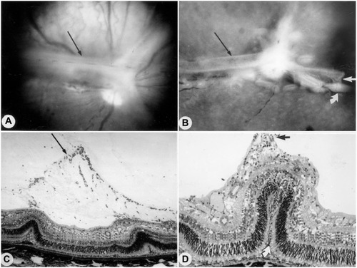 Figure 8 Tented vascularized membrane and tractional retinal folds in a 45-day-old oxygen-treated animal.