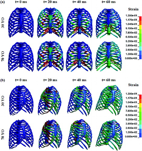 Figure 4 Strain history for the 30-YO and 70-YO male geometric and material property models for the (a) thoracic frontal hub impact and (b) thoracic lateral impact.