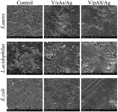Figure 7. Representative SEM images of S.aureus, L.acidophilus, and E.coli after the action of V/sAS/Ag and V/pAS/Ag.