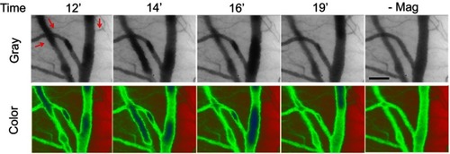 Figure 4 Dynamic retention of MNP with PEG in the representative vessels in magnetic field. Magnetic capture of PEG(+) MNPs (250 nm; 5 mg/kg) in cremaster microcirculation was observed by capillaroscopy under gray and color mode 12–19 mins after administration of the MNPs and 1 min after removal of the magnet (-Mag). The red arrows indicate the flow direction of the adjacent vessel. The results are representative of 6 experiments. Scale bar indicates 50 μm.