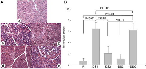 Figure 1 Pancreatic histological alterations (A) and histological scores (B).