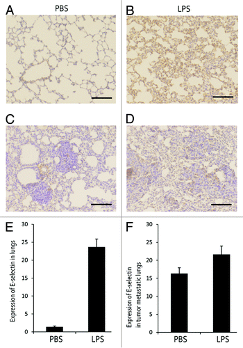 Figure 2. E-selectin expression in LPS-treated mice and metastatic foci. (A, B, and E) E-selectin expression in lungs of PBS- and LPS-treated mouse. (C, D, and F) E-selectin expression in lungs of tumor inoculated mouse.