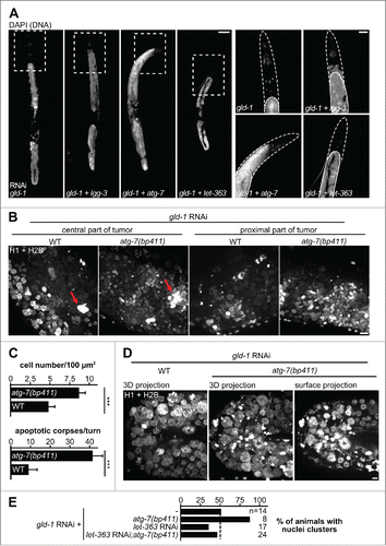 Figure 5. Modulation of autophagy affects tumor growth. (A) N2 L1 or L3 (in the case of let-363 RNAi) larvae treated with the indicated dsRNA(s) till the fourth d of adulthood and stained with the DNA-intercalating dye DAPI (4′,6′-diamidino-2-phenylindole). Left: Representative animals. Right: Enlargement of the head region (boxed areas on the left). Dashed lines indicate the outline of the animal, white lines indicate the gonadal basement membrane. Scale bars: 20 μm. (B) Cell density visualized by fluorescent histone reporters (H1 and H2B-mCherry fusion proteins) in central (left) and proximal (right) parts of gld-1 RNAi-induced germline tumors in wild type and atg-7(bp411) animals. 3D projections are shown. Scale bar: 10 μm. (C) Quantification of cells per area and apoptotic corpses per gonad turn. n = 5 animals each; *** P ≤ 0.001. (D) Gonad turn nuclei and apoptotic corpses in wild-type and atg-7(bp411) animals treated with gld-1 RNAi. 3D projections. Note the chromatin threads that can be observed on goad surfaces in atg-7(bp411) (surface projection, right). Scale bar: 5 μm. (E) Quantification of animals with cell clusters, indicative of high tumor cell density. Animals were treated with the respective RNAis and tumor arms were imaged and scored at d 3 of adulthood for the appearance of bright nuclei clusters (as indicated by red arrows in panel [B]).