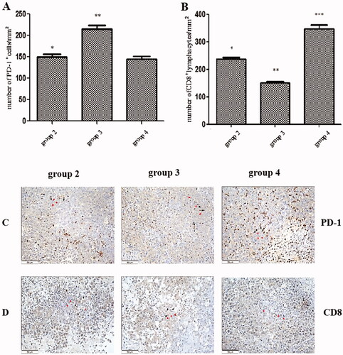 Figure 7. The expression of programmed cell death protein-1 and infiltrated cluster of differentiation 8+ lymphocytes in tumours. (A) The number of programmed cell death protein-1+ cells per square millimetre. (B) The number of clusters of differentiation is 8+ cells per square millimetre. (C) The immunohistochemical (HIC) staining for programmed cell death protein-1+ cells in the tumour tissue in each group. (D) The HIC staining for a cluster of differentiation 8+ cells in tumour tissue in each group. Scale bars, 50 µm. *p < .01 group 2 vs. group 3; **p < .01 group 3 vs. group 4; ***p < .01 group 2 vs. group 4. The HIC staining for cells with the nuclear deposition of violet pigment was positive (black arrow), and the nuclear deposition of blue pigment was negative (red arrow) (original magnification x200). Values are given as the means ± the standard deviation. Group 1 is the mock group; group 2 is the implantation without ALPPS group; group 3 is the implantation/ALPPS group; group 4 is the implantation/CA group.