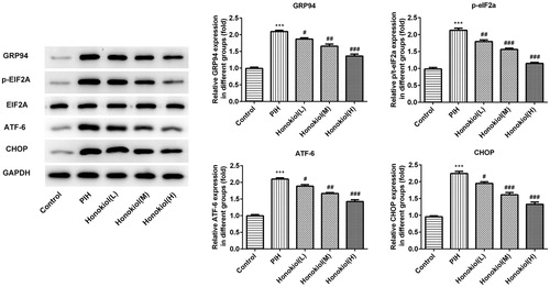 Figure 3. Honokiol attenuated placental ER-stress in PIH rats. Western blot of protein levels of GRP94, eIF2α, p-eIF2α, ATF-6 and CHOP in rat placentas and relative expression. Honokiol doses: 200 μg/kg (L), 600 μg/kg (M) and 2000 μg/kg (H). Note: Relative expression was calculated by dividing the value obtained in the experimental group by the value in the control group. Data are expressed as (mean ± SD) [n = 10]; error bars represent standard deviation (±SD). ***p < 0.001 compared with the control group. ##p < 0.01 and ###p < 0.001 compared with PIH group.