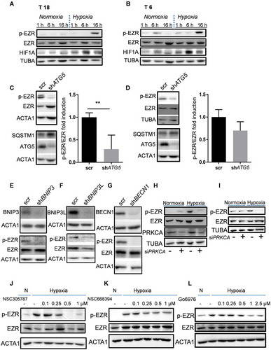 Figure 4. Hypoxia induces EZR phosphorylation in an ATG5-dependent manner. (A-B) Phosphorylation of EZR at Thr567 under normoxic (N) and hypoxic (H) culturing conditions in (A) T18 and (B) T6 TICs. Data are representative of at least four independent experiments. (C-D) Activation of EZR after ATG5 knockdown in (C) T18 and (D) T6 TIC cultures after 16 h of hypoxia. Quantification was performed based on four independent experiments (mean ± SD) and is shown on the right side of the respective graph. *p < 0.05. (E-G) Activation of EZR following silencing of (E) BNIP3 (F) BNIP3L and (G) BECN1 after 16 h of hypoxia in T18 TIC cultures. Data are representative of three independent experiments and similar results were obtained for T6 TICs. (H-I) Effect of PRKCA siRNA on EZR phosphorylation under normoxia and hypoxia (16 h) in (H) T6 and (I) T18 TICs. Data are representative of two independent experiments per TIC culture. (J-K) Effect of NSC305787 and NSC668394, two chemical inhibitors of PKC-mediated EZR phosphorylation in hypoxic (16 h) T6 TICs. Data are representative of at least two independent experiments. (L) Effect of Go6976, a chemical inhibitor of PRKC, on the phosphorylation of EZR in hypoxic (16 h) T6 TICs. Data are representative of three independent experiments.