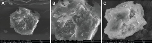 Figure 5 Field emission scanning electron micrographs of Zn/Al-layered double hydroxide (A and B), and of the Zn/Al-layered double hydroxide-levodopa nanocomposite (C).