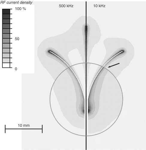 Figure 4. Electrical RF current density for multi-prong electrode, at 500 kHz (left) and 10 kHz (right) in a slice central through three of the prongs. At 10 kHz, current density significantly changes at tumour boundary (arrow). Current density is shown as percentage of maximum. Grey circle represents tumour boundary.