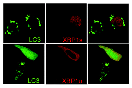 Figure 1. HCT116 cells were transfected with a control plasmid or a plasmid encoding flag-XBP1u or flag-XBP1s. Twenty-four hours after transfection, the cells were subjected to glutamine starvation for 24 h, and the formation of GFP-LC3 punctate signals was observed.