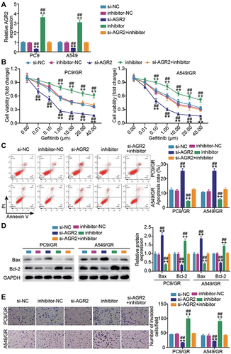 Figure 5 AGR2 knockdown compromises the effect of miR-653-5p inhibitor on gefitinib-resistant LUDA cell growth. (A) Verification of transfection efficiency. PC9 and A549 cells were transfected with si-NC, si-AGR2, miR-653-5p inhibitor, inhibitor-NC and miR-653-5p inhibitor + si-AGR2. After 48h, RT-qPCR was performed to test the miR-653-5p expression. (B–D) PC9/GR and A549/GR cells were transfected with si-NC, si-AGR2, miR-653-5p inhibitor, inhibitor-NC and miR-653-5p inhibitor + si-AGR2. 48h post-transfection. Proliferation curves were obtained using CCK-8 assays (B). Cell apoptosis was detected by flow cytometry (C) and Western blot (D). Cell invasion was determined by Transwell invasion assay (E). **P < 0.001 vs si-NC; ++P < 0.001 vs inhibitor-NC; ##P < 0.001 vs si-AFAP-AS1+inhibitor.