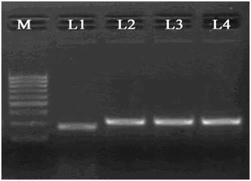 Figure 1. Agarose gel electrophoresis image of the recombinant c-Myc-siRNA-pDNAs: M, 100 bp DNA Ladder (100–1000 bp); L1, empty vector (269 bp); L2–L4, three recombinant c-Myc-siRNA-pDNAs (316 bp).