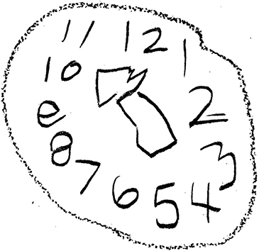Figure 3 ADHD-L DAC drawing with qualitative Errors: Size: Macrographic error (15 cm). Graphomotor: oval instead of circular shape, line wobbly, 9 is reversed; some numbers tilted. Spatial Planning: numbers are well spaced, equal size, 12–6 opposed at an angle, 9- opposed to 2 instead of 3. Conceptualization: hand missing.
