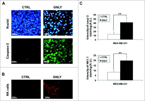 Figure 4. Nuclear staining and immunostaining for caspase-3 and NK1.1 in histological sections of MDA-MB-231-derived tumors. (A, B) Representative images of resected MDA-MB-231-derived tumors from the control group (CTRL) or from the granulysin-treated group (GNLY) of the experiment in Fig. 2A are shown. Nuclei were stained using the Hoechst 33342 nuclear dye (upper panels in A) or immunostained with anti-caspase-3 antibody (lower panels in A) or with anti-NK1.1 antibody (B), as indicated, and photographed in a fluorescence microscope at 400X (A) or 200X (B) magnification. (C) Fluorescent intensity in the caspase-3 or NK1.1 immunostained sections was quantified using the freeware ImageJ v1.33 and results expressed as the mean±SD of the different sections analyzed (at least 10 in each experimental condition) as arbitraty units folllowing the recommendations of the software. **p < 0.02.