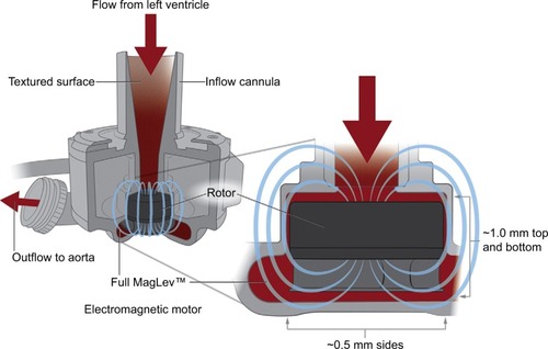 Figure 6 HeartMate 3 Full MagLev™ internal pump design.