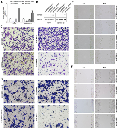 Figure 8 Effects of SORBS1 knockdown or overexpression on BC cells’ invasion and migration. (A) Quantitative PCR analysis of SORBS1 expression levels in si-SORBS1 control, si-SORBS1, oe-SORBS1 control and oe-SORBS1 breast cancer cell lines (MCF-7 and MDA-MB-231). (B) Western blot of SORBS1 expression levels in si-SORBS1 control, si-SORBS1, oe-SORBS1 control and oe-SORBS1 breast cancer cell lines (MCF-7 and MDA-MB-231). (C) Effects of SORBS1 knockdown or overexpressed on invasion of MDA-MB-231 breast cancer cells. (D) Effects of SORBS1 knockdown or overexpressed on invasion of MCF-7 breast cancer cells. (E) Effects of SORBS1 knockdown or overexpressed on migration of MDA-MB-231 breast cancer cells showed by scratch assays. (F) Effects of SORBS1 knockdown or overexpressed on migration of MCF-7 breast cancer cells showed by scratch assays. **:P < 0.01; ***:P < 0.001.