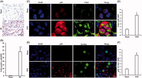 Figure 4. TAK1 expression pattern and the correlation between TAK1 or TUNEL and p38. (A) Representative photomicrographs of TAK1 immunohistochemical staining in kidneys of mice with IR model or Sham (original magnification: ×400, Scale bar: 50 μm). (B) Quantitative analysis of TAK1 positive cells in kidneys of mice with IR model or Sham. ***p < .001 versus sham, n = 6 each. (C) Representative photomicrographs of renal tubular epithelial cells with H/R or sham treatment stained for TAK1, p38 and DAPI. Scale bar: 10 μm. (D) Quantitative analysis of TAK1+ and p38+ renal tubular epithelial cells with H/R or sham treatment. *p < 0.05 versus sham, n = 4 per group. (E) Representative photomicrographs of renal tubular epithelial cells with H/R or sham treatment stained for p38, TUNEL and DAPI. Scale bar: 10 μm. (F) Quantitative analysis of p38+ and TUNEL+ renal tubular epithelial cells with H/R or sham treatment. *p < .05 versus sham, n = 4 per group.