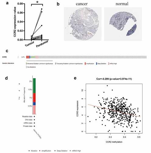 Figure 8. The identification of CCR2 in endometrial carcinoma. (a) The result of qRT-PCR in 11 pairs of tumors and adjacent tissues showed that the transcriptome level of CCR2 was significantly reduced in tumor tissues (P < 0.01). (b) Representative images show the samples stained with CCR2 from the HPA database. The staining intensity was negative in tumor cells, but strong in normal tissue. (c-d) The proportion and distribution of samples with genetic alterations of CCR2 in EC. (e) Correlation between CCR2 methylation level and its expression in EC