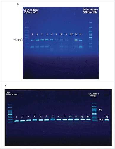 Figure 2. Agarose gel electrophoresis amplification of L. pneumophila by A) conventional-PCR (340bp) and B) nested –PCR (124bp) of the mip gene detected in cooling water samples in this study. Lanes 7-9 and 12 are water samples from Bam. Lane 11 is positive control (340bp). Lanes 1 and 14 are ladder consist of 100 base pairs DNA fragments. NC = negative control.