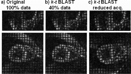 Figure 2. Comparison of 3D tagging images reconstructed from full data (a) and from reduced number of samples in k-t space (40% of full data used) (b) in volunteer #1. Data obtained with the reduced acquisition scheme in volunteer #2 (c). Long-axis (upper row) and short-axis views (lower row) at peak systole are shown.