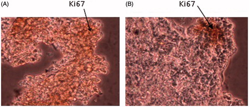 Figure 4. Expression of Ki67 in tumor tissues. (A) Expression of Ki67 in control group. (B) Expression of Ki67 in IL-12 treated group. Expression of Ki67 was reduced in IL-12 treated group incomparable to control group.