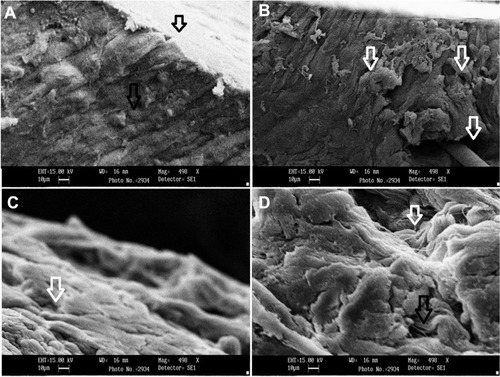 Figure 9 Scanning electron microscopy of rat skin treated with the optimized formulations.Notes: (A) Untreated skin showing intact and normal architecture of the epidermal layer (represented with a black arrow). (B) Skin treated with OCNE-1 nanoemulsion showed significant structural changes in the upper SC layer (indicated by white arrows). (C) Skin treated with OCNE-1 gel showed perturbations in the upper SC layer (indicated by white arrows). (D) Skin treated with OCNE-1T gel showed additive perturbation of the upper SC layer by the nanoemulsion and gel that contained the permeation enhancer Transcutol (indicated by white arrows). Scale bar = 500 µm and magnification is 15,000×.