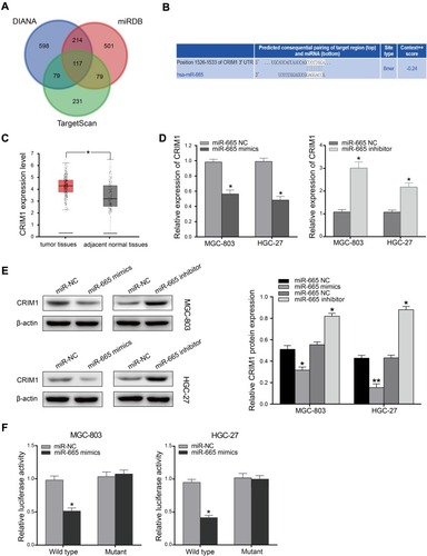 Figure 4 CRIM1 is a direct target gene of miR-665. (A) Target genes of miR-665 were predicted using three online databases (TargetScan, miRDB, and miRWalk). (B) miR-665 binding site was predicted in CRIM1 3′UTR by TargetScan. (C) Expression of CRIM1 in GC (GEPIA). (D) qRT-PCR analysis of CRIM1 expression in MGC-803 and HGC-27 cells transfected with miR-665 mimics or miR-665 inhibitor. (E) Expression of CRIM1 was measured by Western blotting 24 h after transfection with miR-665 mimics or miR-665 inhibitor in MGC-803 and HGC-27 cells. (F) CRIM1-3ʹUTR-wt, CRIM1-3ʹUTR-mut, miR-665 mimics, and miR-665 NC were transfected into MGC-803 and HGC-27 cells and luciferase activity was detected. Data are presented as mean ± SD. *P < 0.05, **P < 0.01.