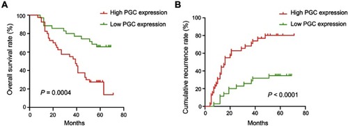 Figure 2 Overall survival and disease-free survival times of 75 pairs of HCC and adjacent non-tumor tissues using Kaplan–Meier analysis. (A) Overall survival (OS) for Pepsinogen C (PGC) expression (P=0.0004). High PGC expression group showed poor OS than low PGC expression group. (B) Disease-free survival (DFS) for PGC expression (P<0.0001). High PGC level group showed poor DFS than low PGC expression group.