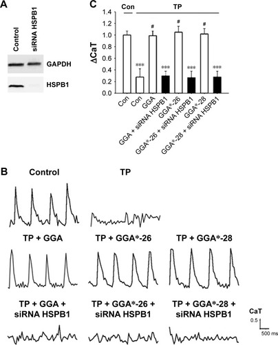 Figure 4 siRNA against HSPB1 abrogated the protective effect of the GGA-derivatives in HL-1 cardiomyocytes.