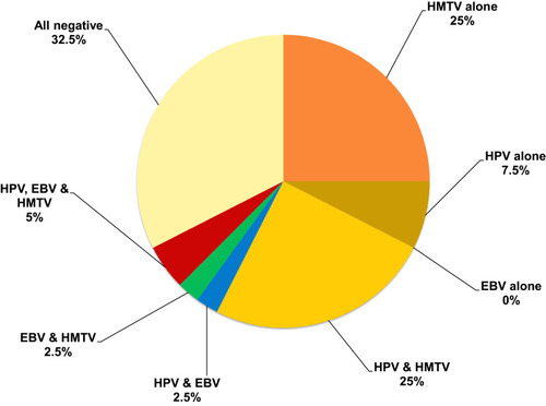 Figure 2 Detection of single and multiple HPV, EBV and HMTV infection among 40 BC WBCs samples. HPV/EBV/HMTV DNAs together were found in only 5%. The most frequent viruses present in co-infection were HPV/HMTV in 25% followed by EBV/HMTV in 2.5% and EBV/HPV in 2.5%. HMTV was the predominating single virus present in 25% followed by HPV in 7.5%.