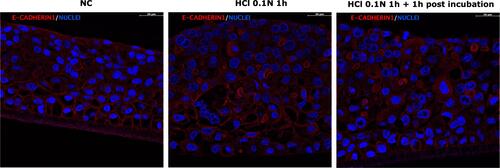 Figure 9 Immunofluorescence of E-Cadherin in untreated HO2E/12 tissues (NC) and HO2E/12 exposed to HCl 0.1N (pH 1.2) for 1h without (series HCl 0.1N 1h) or with 1h post incubation period (series HCl 0.1N 1h + 1h post incubation). Nuclei are stained in blue (DAPI). Magnification 63x. Scale bar = 30 μm. Representative images selected within triplicate series.
