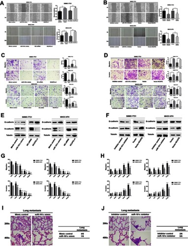 Figure 2 miR‑181c is able to regulate migration and invasion in HCC cells. (A) Wound healing assays were used to detect cell migration after transfection with miR-181c mimics and NCAPG siRNA. (B) Wound healing assays were used to detect cell migration after transfection with miR-181c inhibitors and vector-NCAPG. (C) Transwell assays were used to investigate cell migration and invasion after transfection with miR-181c mimics and NCAPG siRNA. (D) Transwell assays were used to investigate cell migration and invasion after transfection with miR-181c inhibitors and vector-NCAPG. (E) Western blotting analysis of E-cadherin and N-cadherin expression after transfection with miR-181c mimics and NCAPG siRNA. (F) Western blotting analysis of E-cadherin and N-cadherin expression after transfection with miR-181c inhibitors and vector-NCAPG. (G) Dose-dependent effect experiment of miR-181c mimic (left) and NCAPG siRNA (right). (H) Dose-dependent effect experiment of miR-181c inhibitor (left) and Vector-NCAPG (right). (I) Representative H&E–stained sections of the lung tissues collected from Mimic control and miR-181c mimic groups are shown in the left. The incidence of lung metastases in the two groups of nude mice is shown in the right. (J) Representative H&E–stained sections of the lung tissues collected from Inhibitor control and miR-181c inhibitor groups are shown in the left. The incidence of lung metastases in the two groups of nude mice is shown in the right. *p<0.05, **p<0.01, ***p<0.001, ****p<0.0001.Abbreviation: HCC, hepatocellular carcinoma.