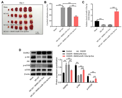 Figure 6 Exosomal miR-133a-3p derived from BMSCs markedly attenuated the symptom of CI/R injury in vivo. In vivo middle cerebral artery occlusion (MCAO) model in rats was established. At the end of the study, rats were sacrificed and the brain tissues were collected. Then, (A) the brain tissues were pictured, and TTC staining was performed to observe the severity of CI/R injury. (B) Cerebral infarction area was detected. (C) The expression of miR-133a-3p in tissues of rats was detected by RT-qPCR. (D) The protein levels of DAPK2, Akt, p-Akt, mTOR and p-mTOR in SH-SY5Y cells were investigated by Western blot. **P< 0.01.