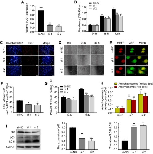 Figure 3 si-TUG1 suppresses proliferation and migration while induces autophagy in HUVECs.