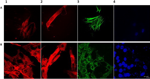 Figure 1. Immunofluorescence microscopy images of HFF cell line (A) and primary GLC culture isolated from human follicular fluid (B). Immunofluorescence signal for MT1 melatonin receptor in control (1) and cells incubated with 10 nmol/L melatonin for 24 h (2); visualization of actin filaments in HFF (3A); immunofluorescence staining of P450 aromatase in GLC (3B); detection of cell nuclei with DAPI (4). Note: Scale bar = 20 μm (63×, Leica CM).