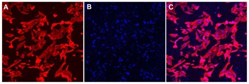 Figure 7 Rhodamine-phalloidin and DAPI stained osteoblast cells grown in gellan xanthan gels at 48 hours, (A) rhodamine phalloidin stained F-actin, (B) DAPI stained nuclei of osteoblasts, (C) merged image.Abbreviation: DAPI, 4′,6-diamidino-2-phenylindole.