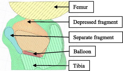 Figure 2. A sagittal plan of the model geometries.