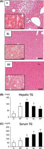 Fig. 1. The effects of RPE on hepatic TG accumulation.