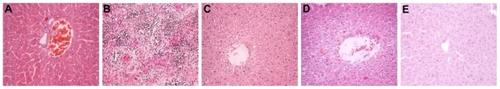 Figure 5 Histopathology of liver tissues of mice after allo-HSCT [hematoxylin and eosin, magnification ×4 (objective lens)]. (A) Control group; (B) irradiation-only group; (C) Fe3O4 MNPs-treated group; (D) CsA-treated group; (E) CsA + Fe3O4 MNPs-treated group.Abbreviations: allo-HSCT, allogenetic hematopoietic stem cell transplantation; CsA, cyclosporine A; Fe3O4 MNPs, Fe3O4 magnetic nanoparticles.