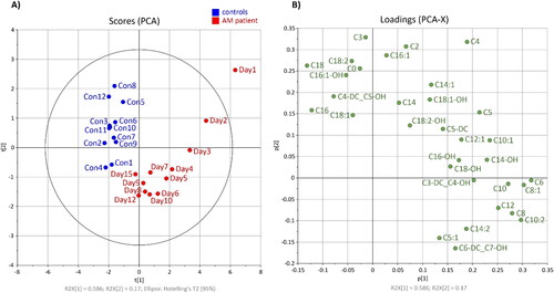 Figure 2. Principal component analysis: (A) score plot of AM-affected horse during 15 days of hospitalisation (red) and 12 samples from healthy controls (blue); (B) loading plot of carnitine and 31 acylcarnitines.